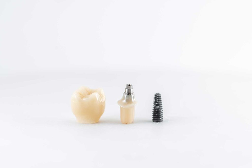Zubné náhrady, Zubné protézy